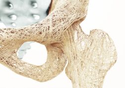 Osteopenie/Osteoporose